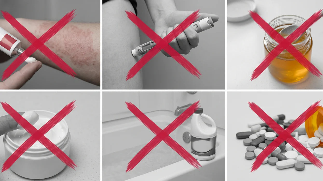 Steroids, biologics, elimination diets — all crossed out